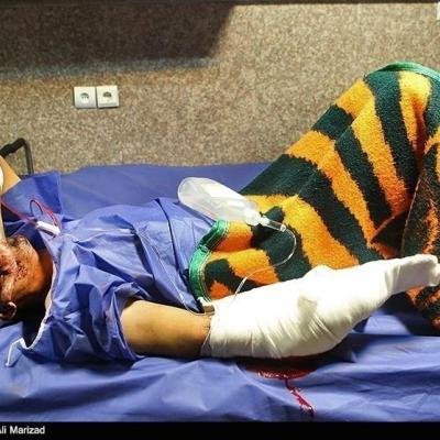 ۱۰ نفر در حوادث چهارشنبه‌ آخر سال در لرستان مصدوم شدند